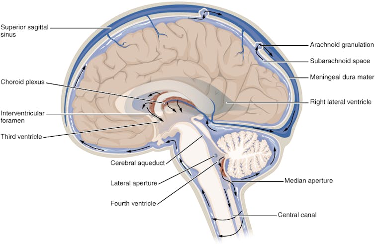 Diagram of cross-section of brain depicting cerebrospinal fluid circulation