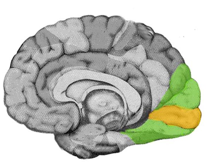 An image of a brain. The primary and secondary visual cortices in the back of the brain are highlighted.