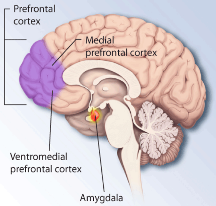 A diagram of the human brain with the prefrontal cortex highlighted at the front.