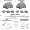 Alignment of brain embeddings and artificial contextual embeddings ...