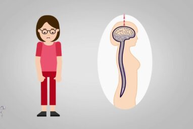 Fluid keeps your brain from crushing itself and shields your spine ...