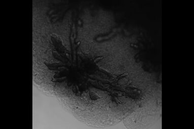 Mammary glands in a dish − what miniature organs reveal about ...