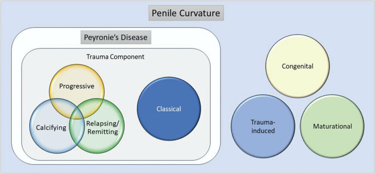 PTNM' system provides new classification for Peyronie's disease ...