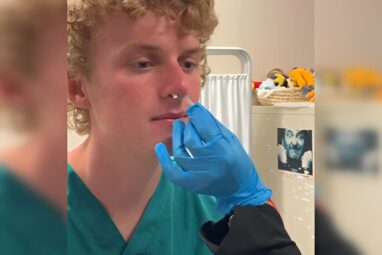 Researchers find e-cigarette use disrupts the nasal microbiome