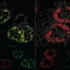 Study maps how genes instruct kidneys to develop differently in ...