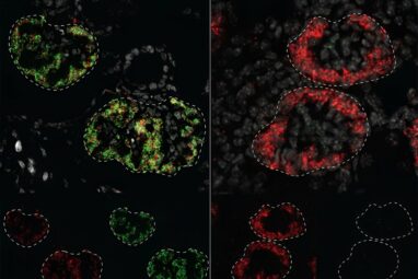 Study maps how genes instruct kidneys to develop differently in ...