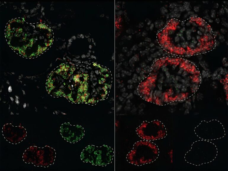 Study maps how genes instruct kidneys to develop differently in ...