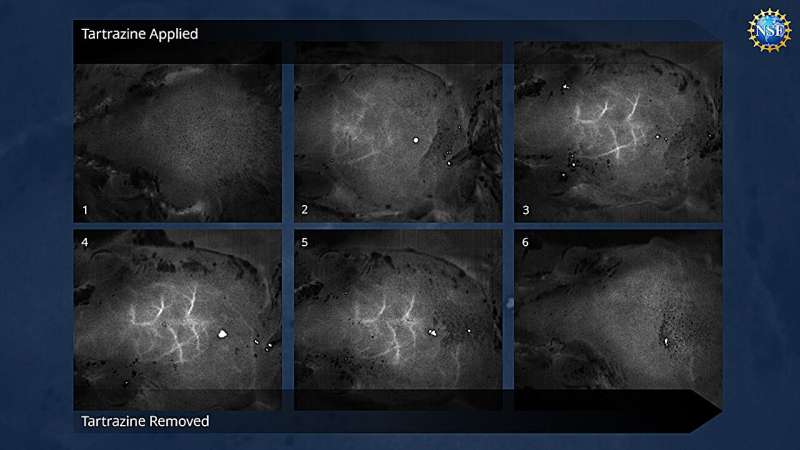 A window into the body: groundbreaking technique makes skin invisible