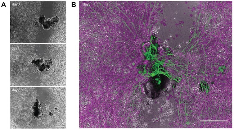 Microscopy images of a black blob fusing together two groundglass walls in three panels, and a green web plugging a gap in a web of pink