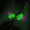 Double-edged STING: A new pathway involved in aging