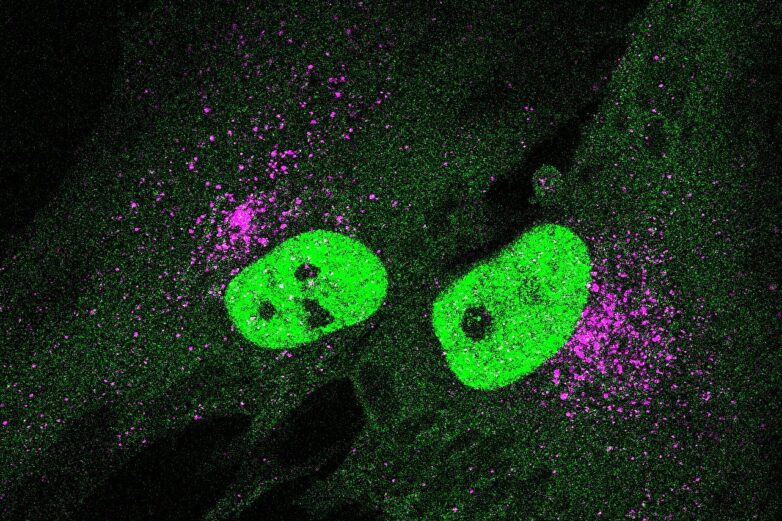 Double-edged STING: A new pathway involved in aging