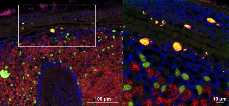 Hijacking the command center of the cell: Nuclear parasites in ...