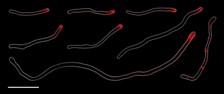 Human mouth bacteria reproduce through rare form of cell division ...