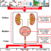 Plastic induced urinary tract disease and dysfunction: a scoping ...