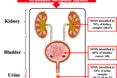 Plastic induced urinary tract disease and dysfunction: a scoping ...