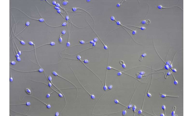 Scientists show how sperm and egg come together like a key in a lock