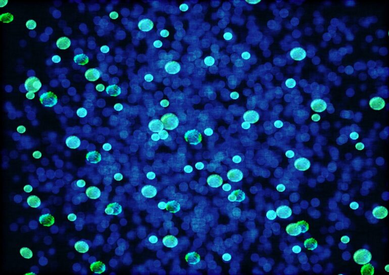 Microbes in environment drove methane emissions more than fossil ...