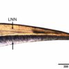 Microscopic study of milk teeth reveals mystery of Iberian culture ...