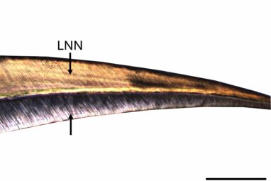 Microscopic study of milk teeth reveals mystery of Iberian culture ...