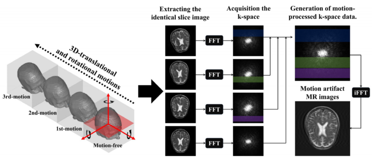 Motion Artifact Reduction Using U-Net Model with Three-Dimensional ...