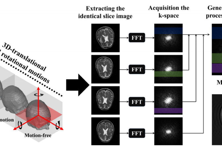 Motion Artifact Reduction Using U-Net Model with Three-Dimensional ...