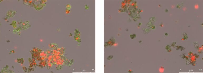 Some microbes used poison gas in battle for iron in the Earth's ...