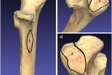 3D fossil scans investigate the origins of bipedal locomotion in ...