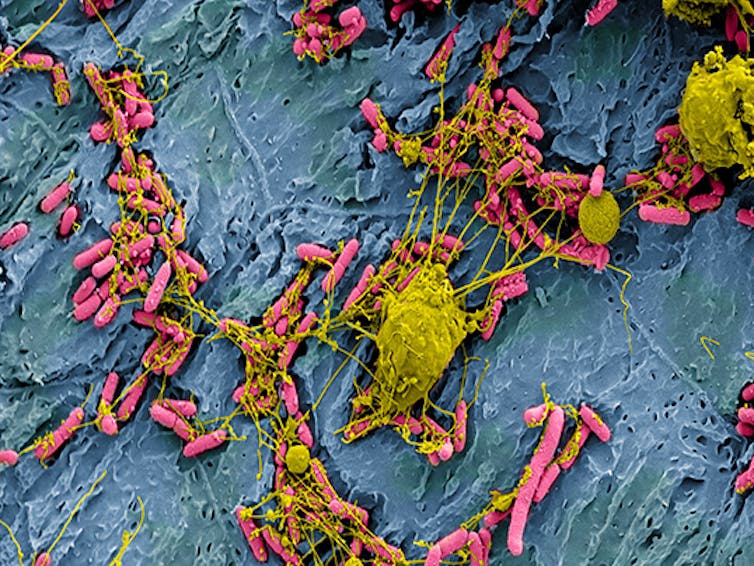 Micrograph of clusters of pink rods scattered across a blue textured wall, while yellow blobs extend thin tendrils across the clumps