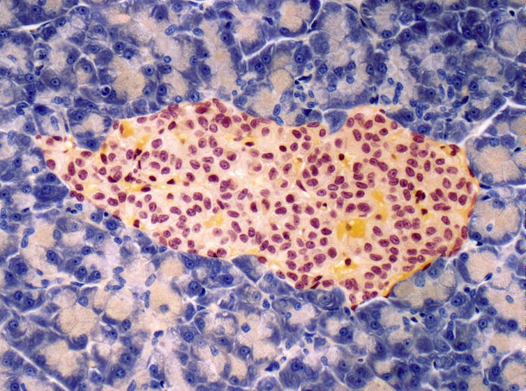 Microscopy image of oblong blob of yellow and pink cells surrounded by violet cells