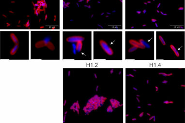 Human histones show promise in fighting bacterial infections