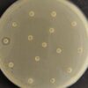 Multidrug-resistant strain of K. pneumoniae detected in Northeast ...