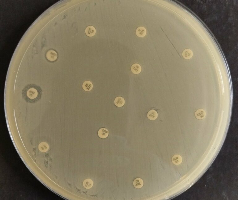 Multidrug-resistant strain of K. pneumoniae detected in Northeast ...