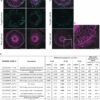 Scientists shed light on an arms race between barley and a fungal ...