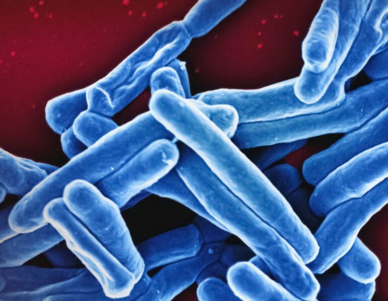 Study challenges assumptions about how tuberculosis bacteria grow