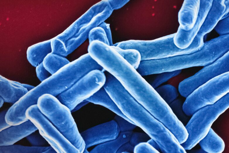 Study challenges assumptions about how tuberculosis bacteria grow