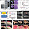 Super-adhesive patches can adapt to different motions for enhanced ...