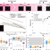 Centripetal nuclear shape fluctuations associate with chromatin ...