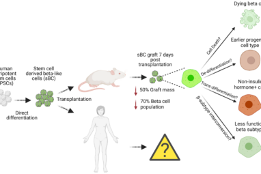 Cell Replacement Therapy for Type 1 Diabetes Patients: Potential ...