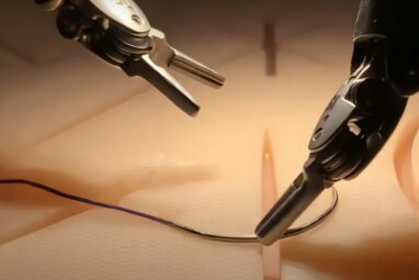 Watching surgery videos allows robot to perform with skill of ...