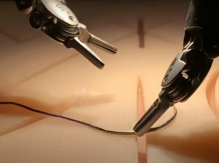 Watching surgery videos allows robot to perform with skill of ...