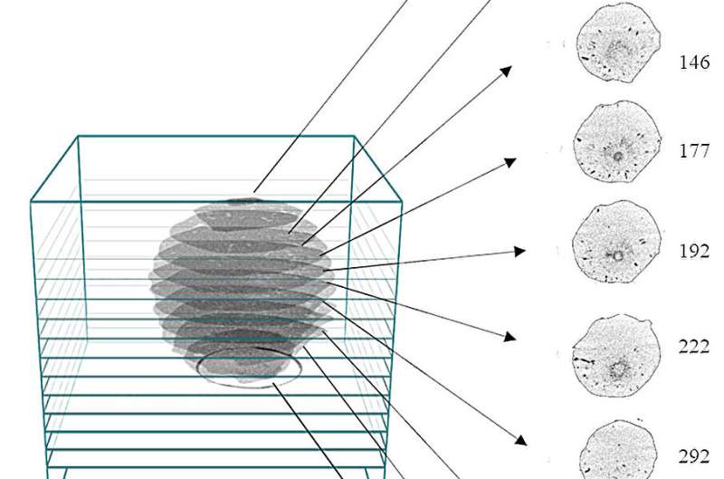 3D scans of giant hailstones reveal surprising discoveries that could help predict future storms