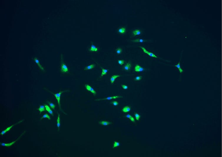 Microscopy image of flecks of fluorescent green with blue nuclei against a black background