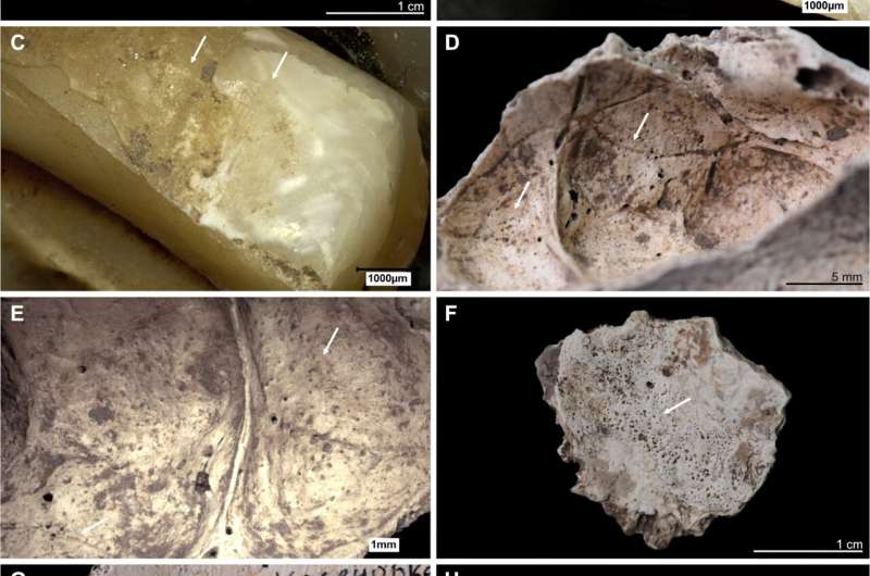 New study reveals unique insights into the life and death of Stone Age individuals from modern-day Ukraine