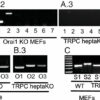 Calcium channel regulation study helps settle a decades-long debate