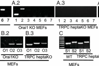 Calcium channel regulation study helps settle a decades-long debate