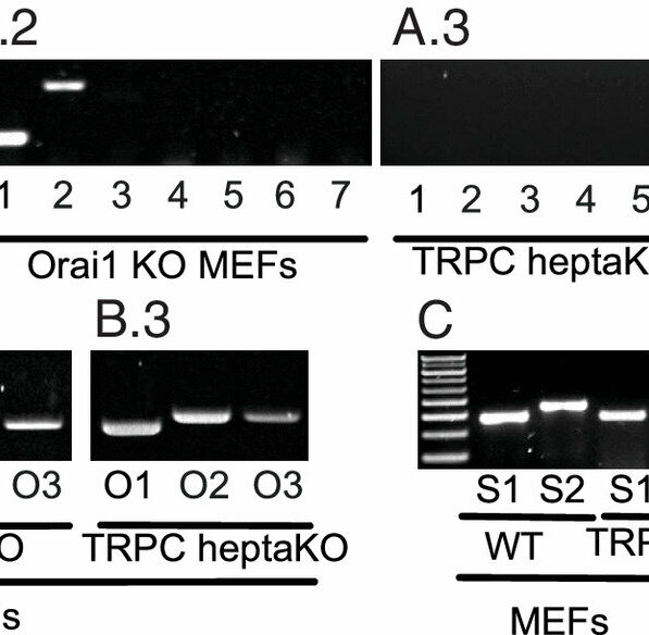 Calcium channel regulation study helps settle a decades-long debate