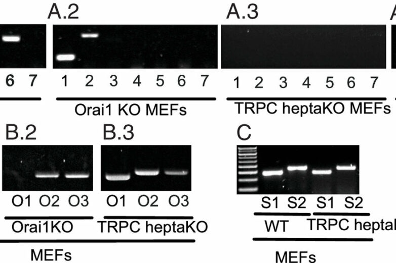 Calcium channel regulation study helps settle a decades-long debate