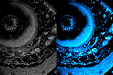 Noninvasive imaging method can penetrate deeper into living tissue