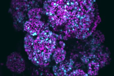 Novel organoid mimics all three key cell types of pancreas to ...