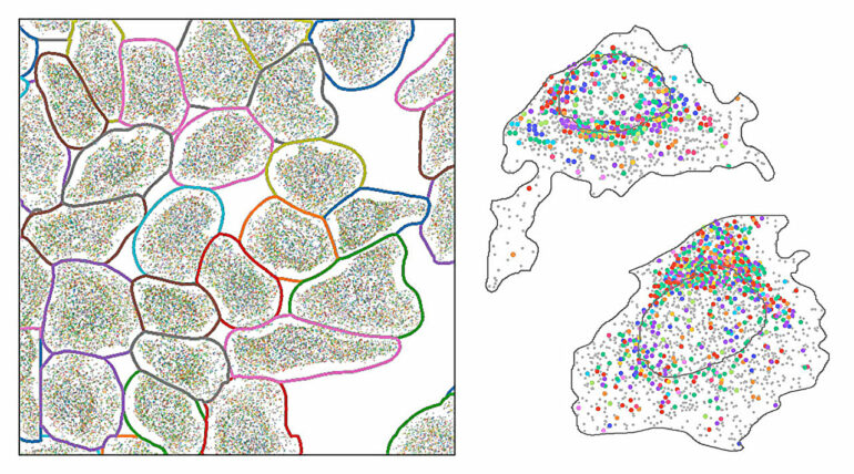 Spatial transcriptomic analysis toolkit can extract biological ...